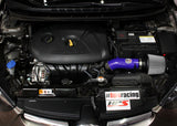 HPS Performance Air Intake Kit with Heat Shield, Blue, 827-538BL