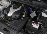 HPS Performance Air Intake Kit with Heat Shield, Blue, 827-587BL